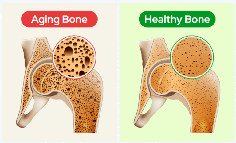 Biocal Bone Support benefits