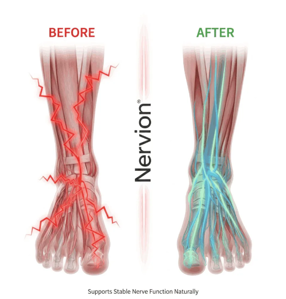 Nervion Before & After